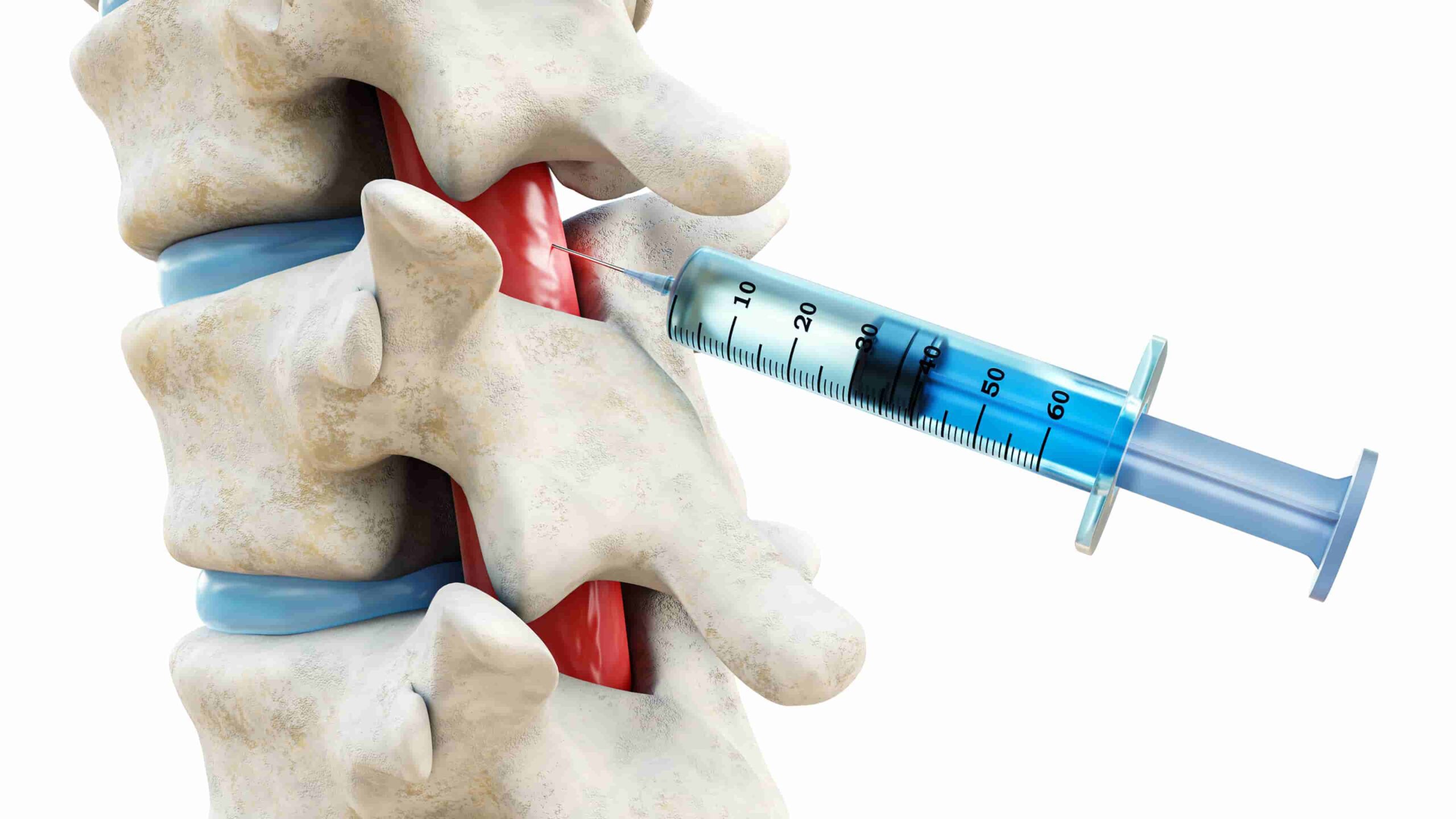 foto de médico especialista em coluna