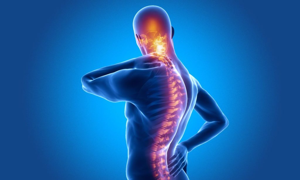ilustração de corpo humano com esqueleto mostrando espondilose cervical