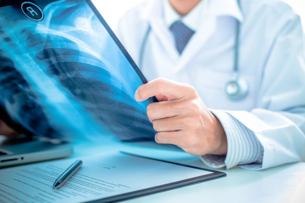 As radiografias podem ajudar no diagnóstico dos nódulos de Schmorl.