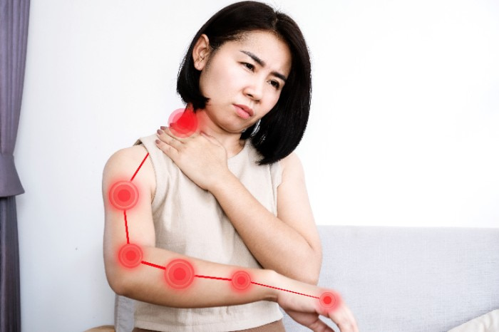 foto de cervicobraquialgia