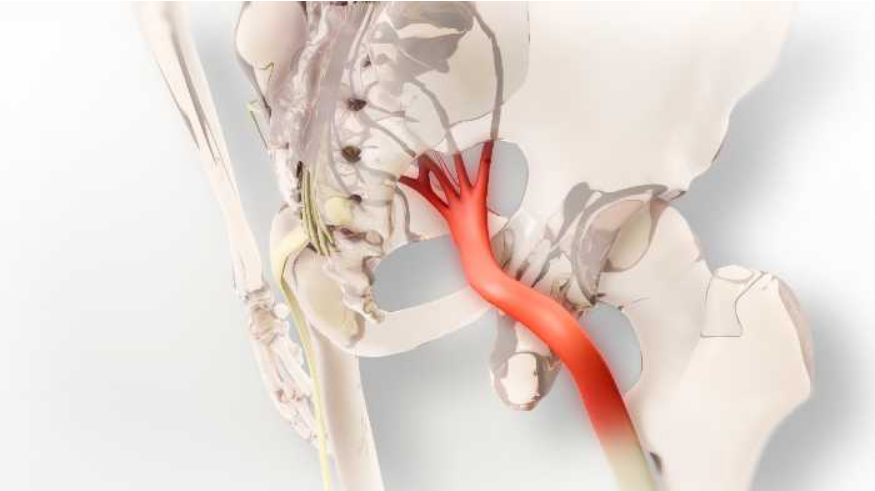 dor-irradiada-itc-vertebral
