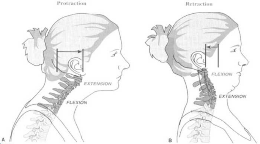 retificação-da-lordose cervical-itc-vertebral