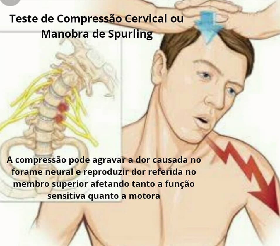 teste de Spurling