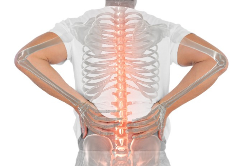 A síndrome facetária é uma condição que afeta as articulações facetárias