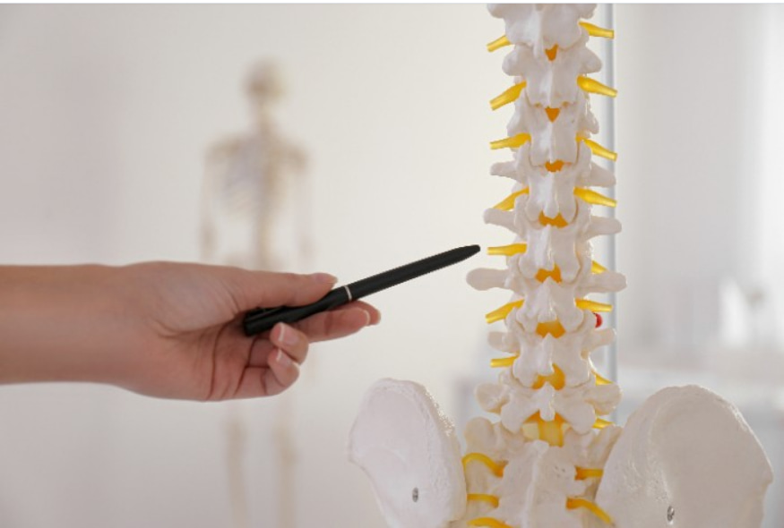 Sempre enfatizamos que a cirurgia, como a Discectomia Percutânea, nunca deve ser a primeira alternativa para tratar a coluna.