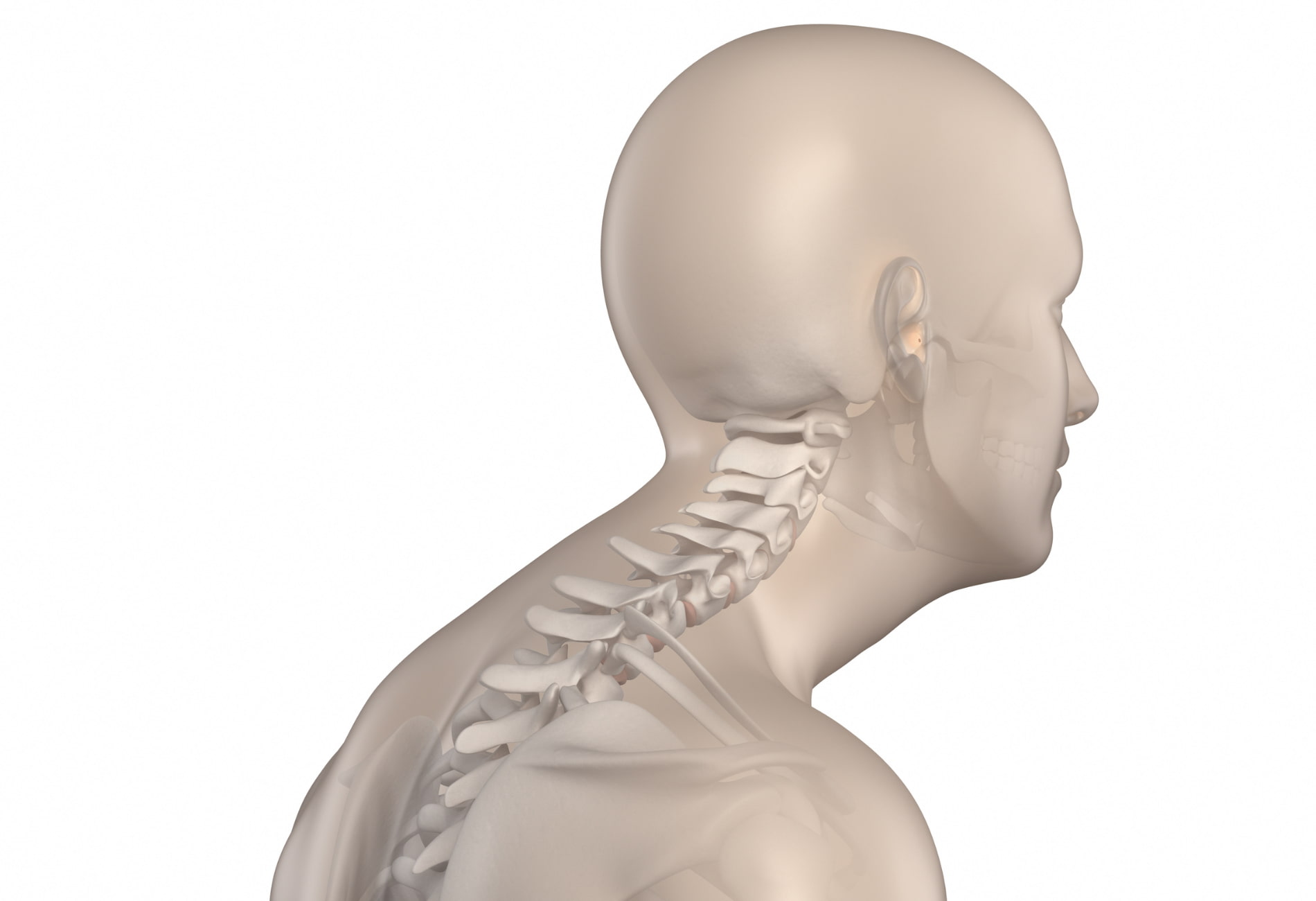 “Ilustração 3D da coluna cervical e torácica evidenciando a corcunda no pescoço”