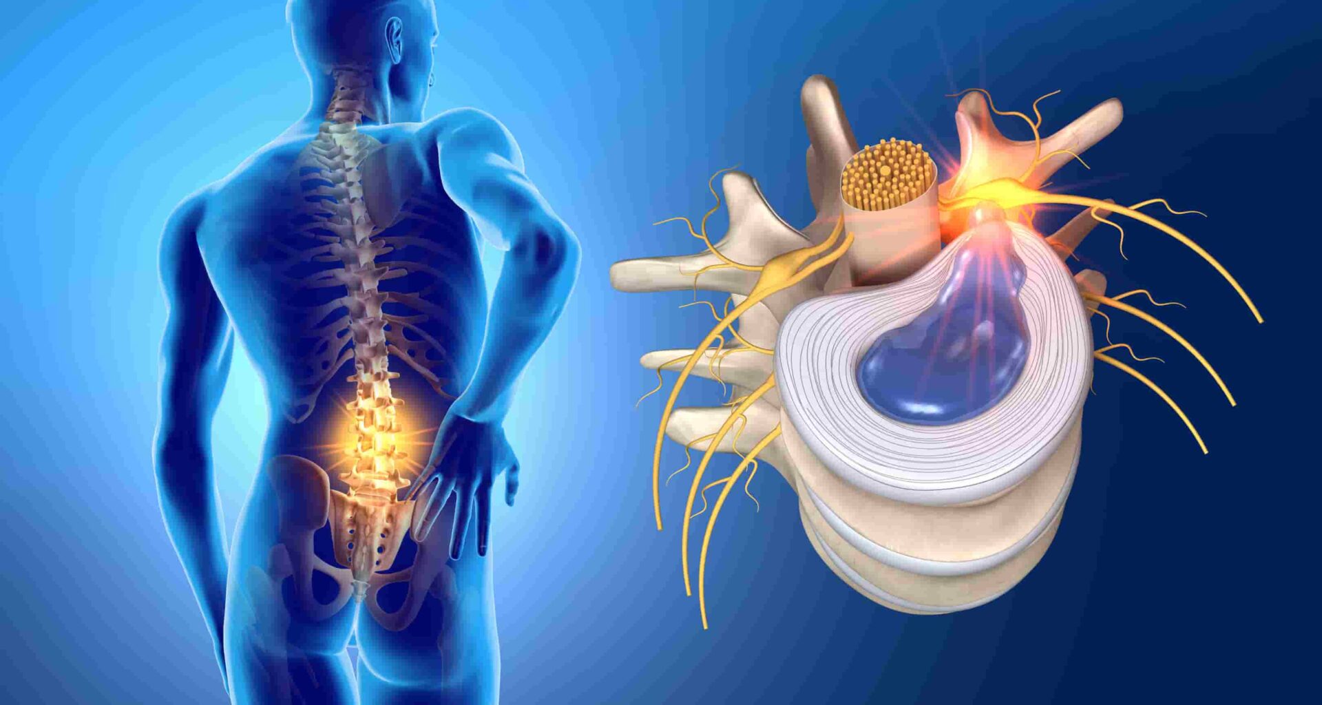 Disco intervertebral