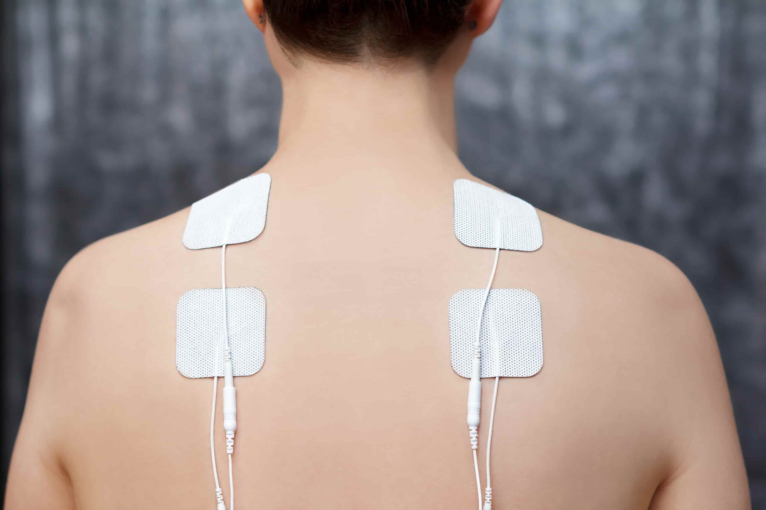 foto de choquinho fisioterapia