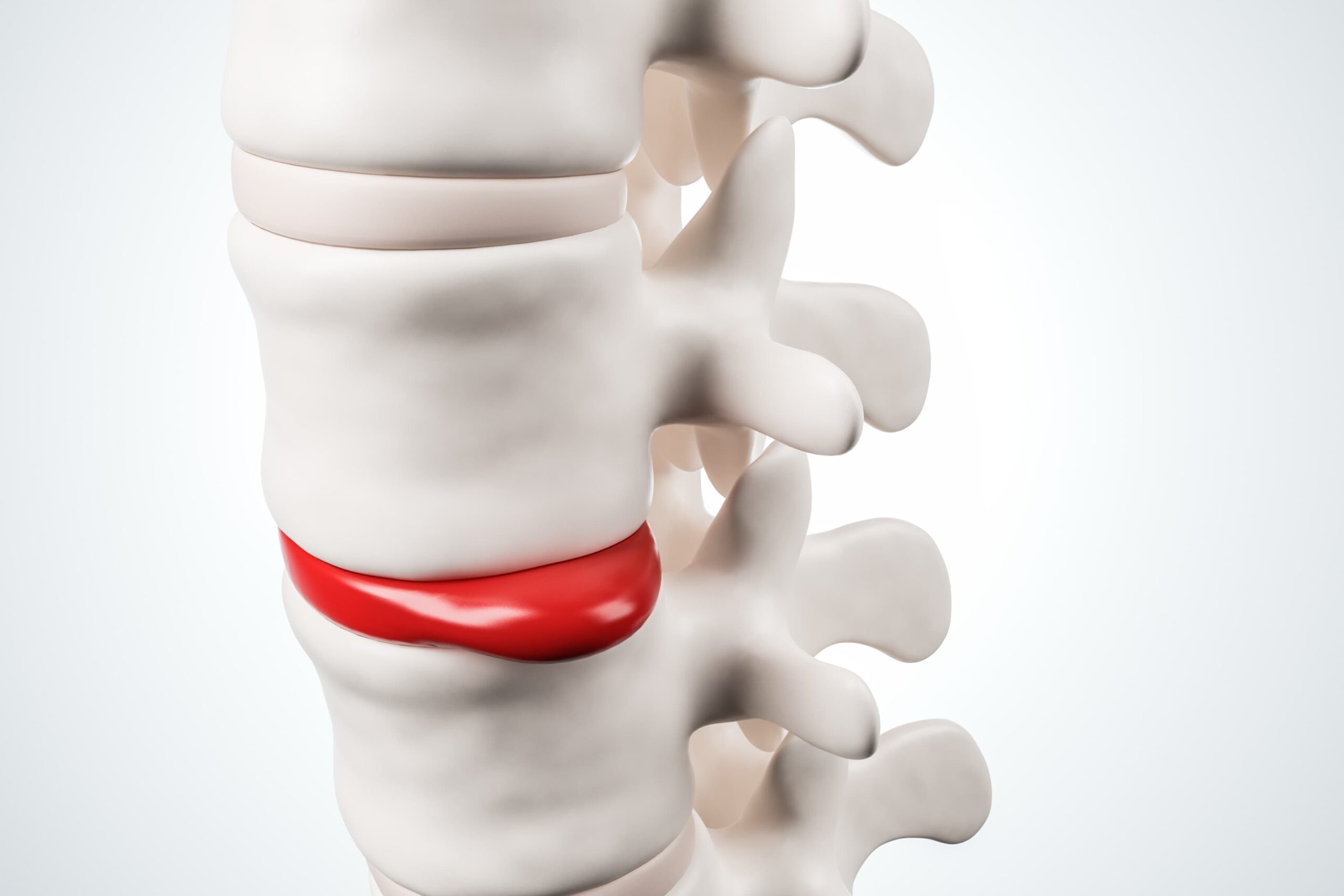 foto de cirurgia na coluna é perigoso