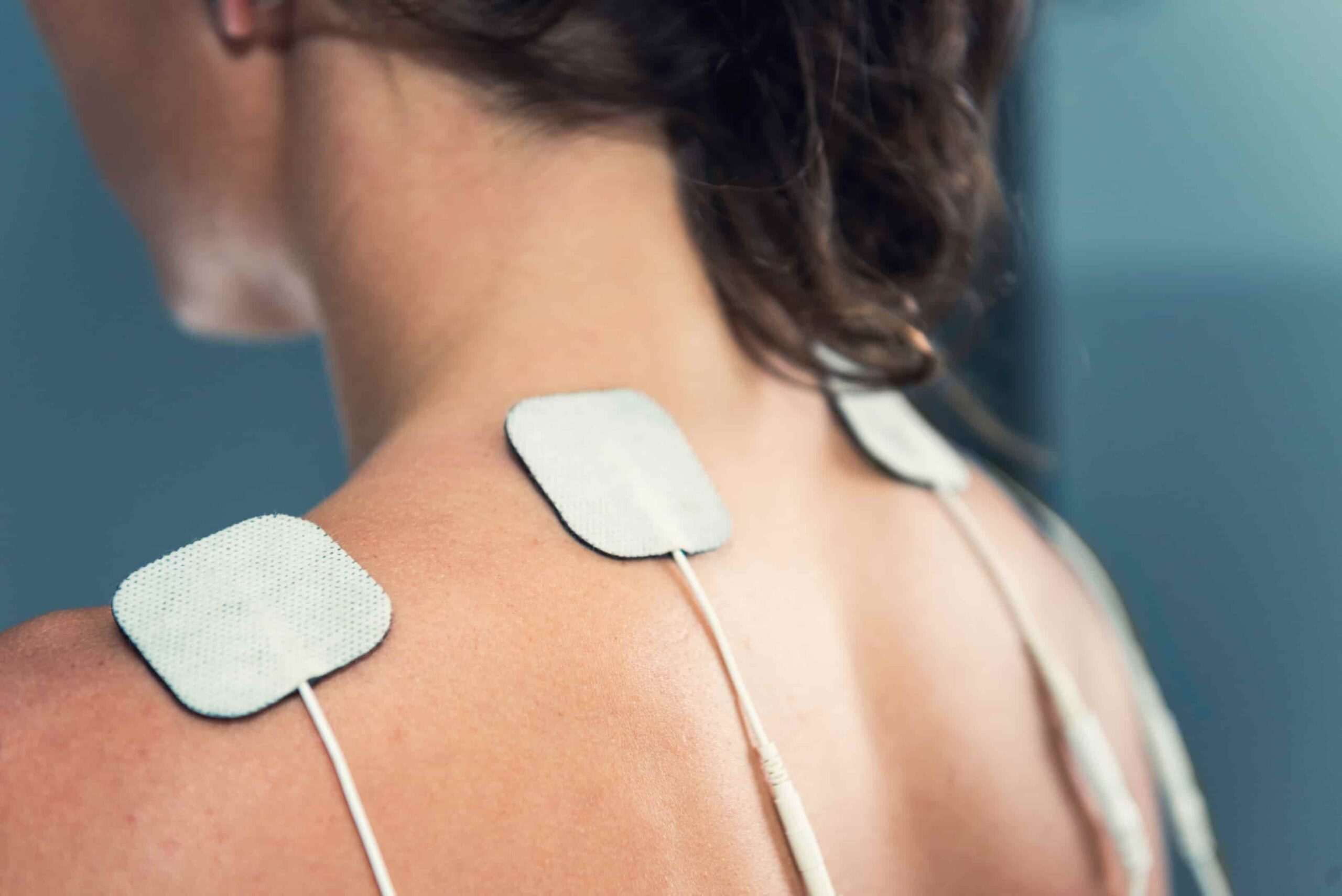 foto de TENS fisioterapia