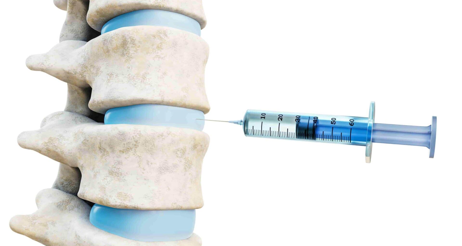 foto de cirurgia na coluna
