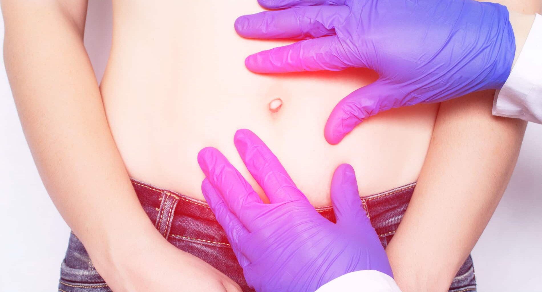 foto de hernia