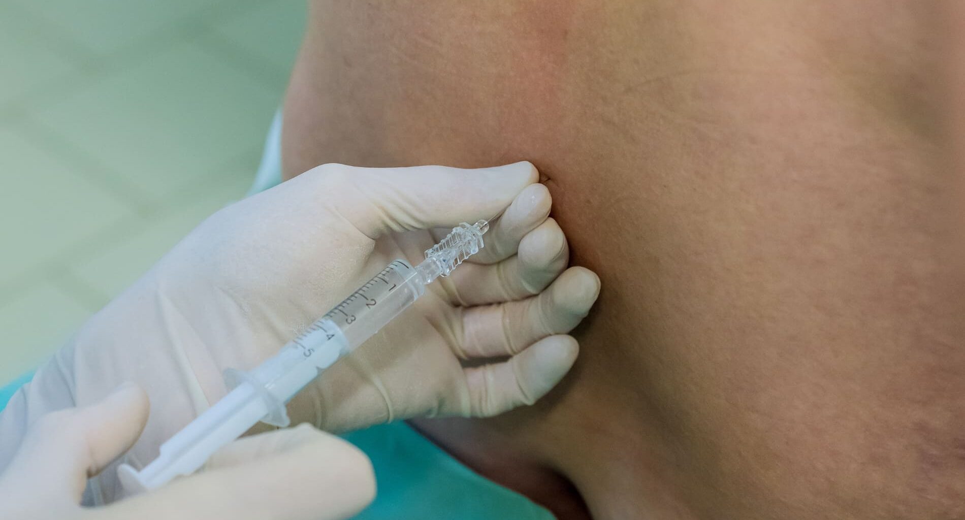 Um profissional de saúde administrando uma injeção de corticoide para dor lombar nas costas de um paciente na ITC Vertebral.