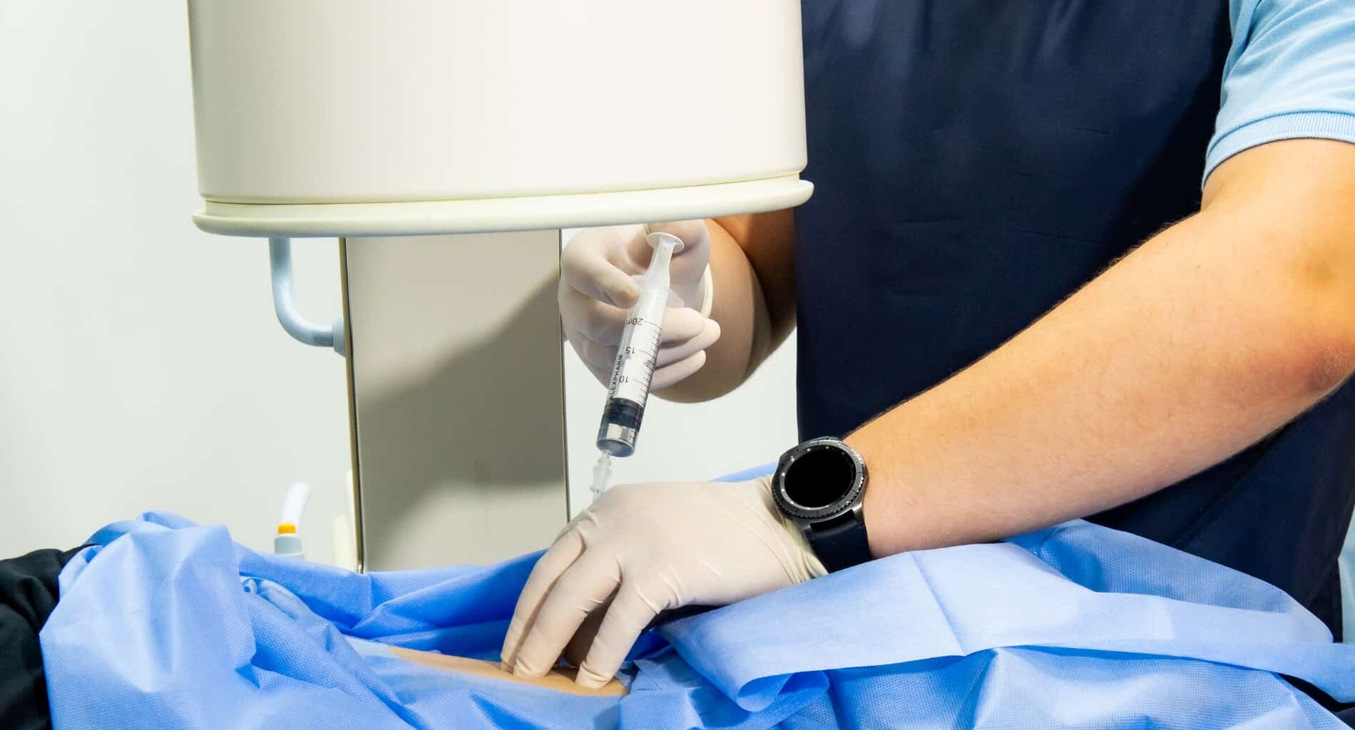 Profissional de saúde segurando uma seringa para um procedimento de bloqueio epidural assistido por fluoroscopia para tratamento de dor lombar.