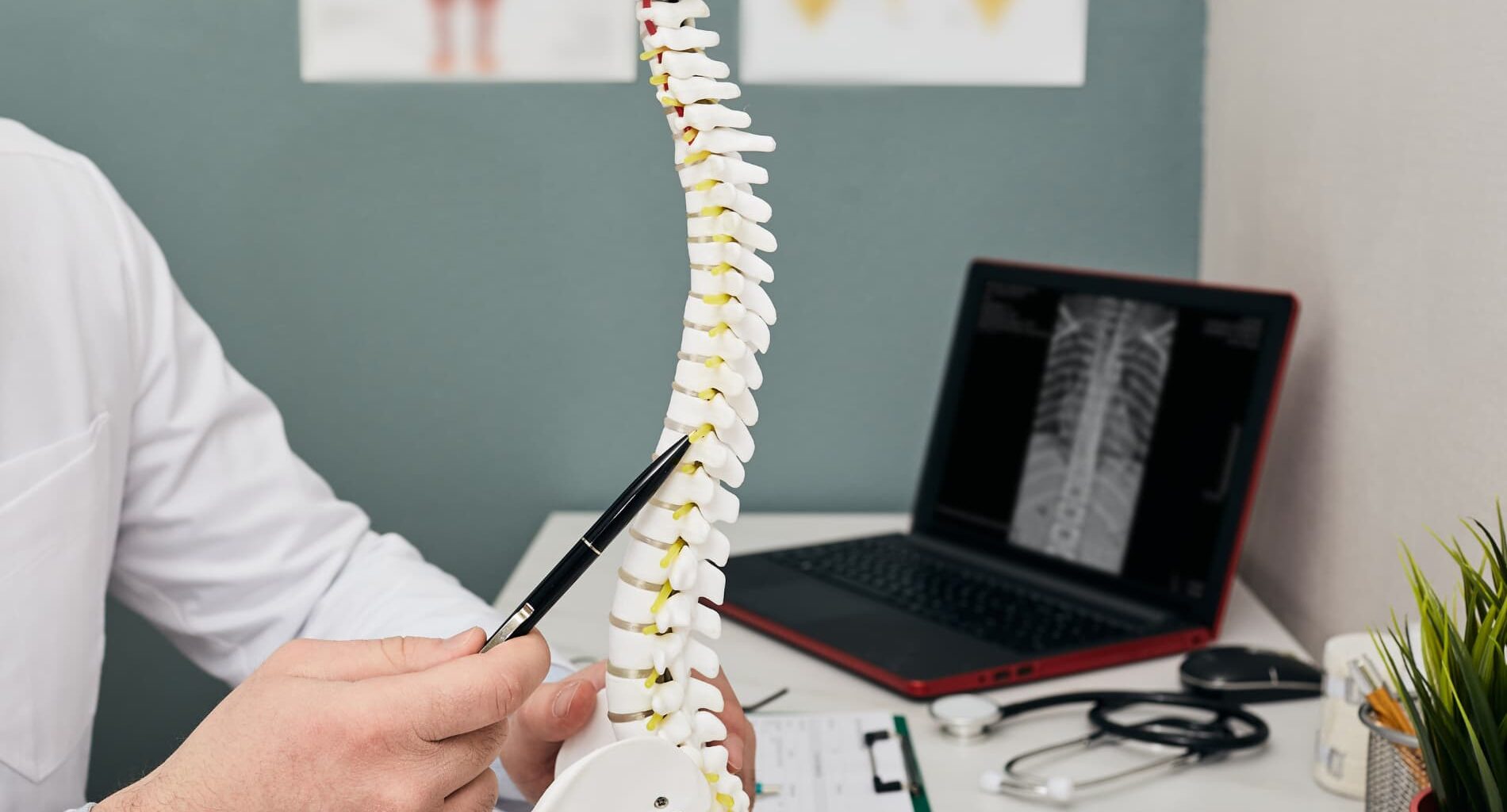 Um especialista em tratamento de coluna apontando para a área lombar em um modelo anatômico de coluna vertebral, com um raio-X visível no notebook.